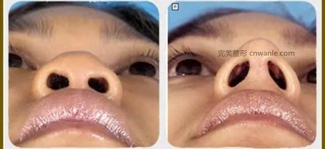 暫無