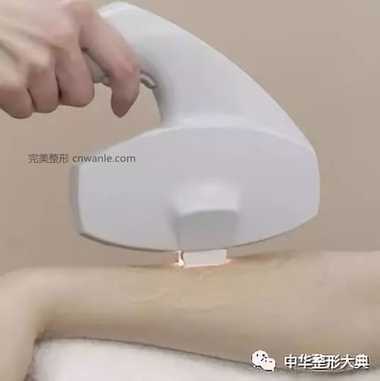 冰點(diǎn)脫毛的操作步驟及優(yōu)勢 | 科普篇?