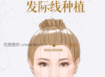 發(fā)際線種植和紋發(fā)際線哪種好呢