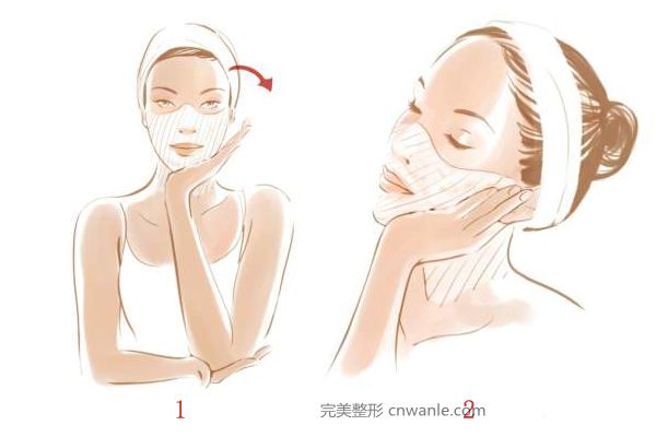 電波拉皮能保持多久 電波拉皮多久有效果