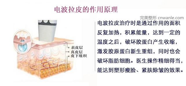 電波拉皮的原理