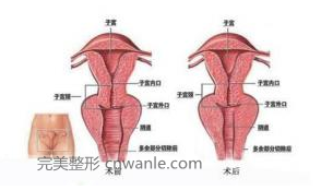 陰道緊縮術(shù)