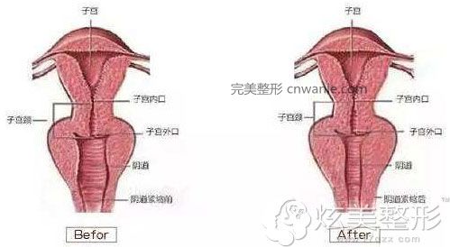 引導(dǎo)緊縮原理圖韓國好手藝