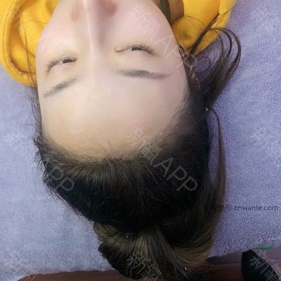 術(shù)后當(dāng)自強