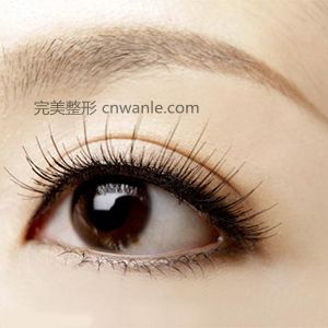 成都藝星開眼角手術效果怎么樣
