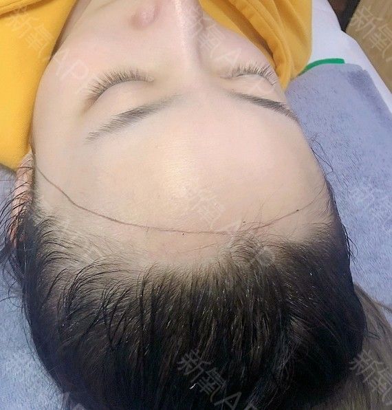 術(shù)后當(dāng)自強