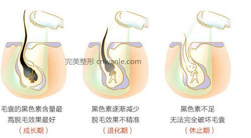 冰點(diǎn)華爾茲<a href='/tag_tuomao16.html'>脫毛</a>有什么優(yōu)勢(shì)