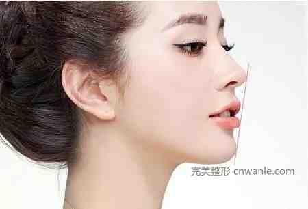 玻尿酸<a href='/tag_dianxiaba20.html'>墊下巴</a>多少錢(qián)一針要幾支才定型？<a href='/tag_boniaosuandianxia2.html'>玻尿酸墊下巴</a>多久恢復(fù)自然
