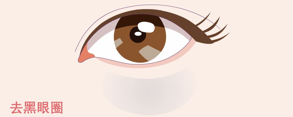 黑眼圈很重是什么原因 黑眼圈很重怎么辦 黑眼圈很重如何消除